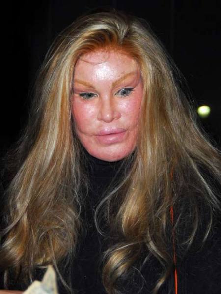 cat-woman-aka-jocelyn-wildenstein--large-msg-120343681936